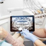 are dental x-rays safe