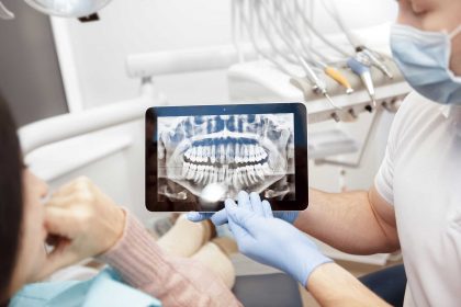 are dental x-rays safe