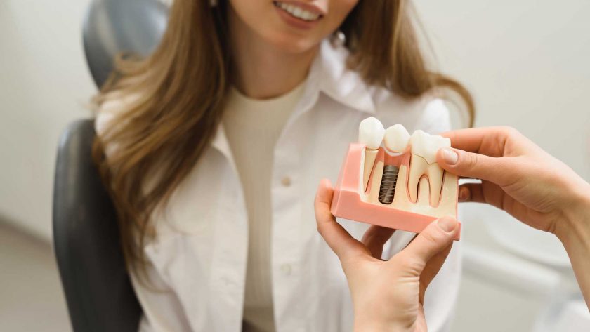 what are dental implants