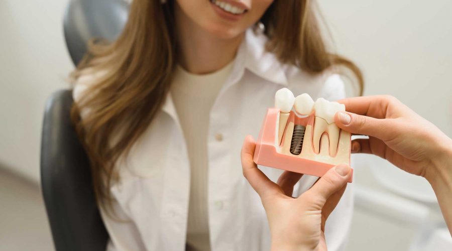 what are dental implants