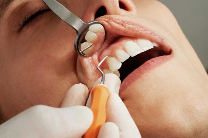 how often should i get my teeth cleaned